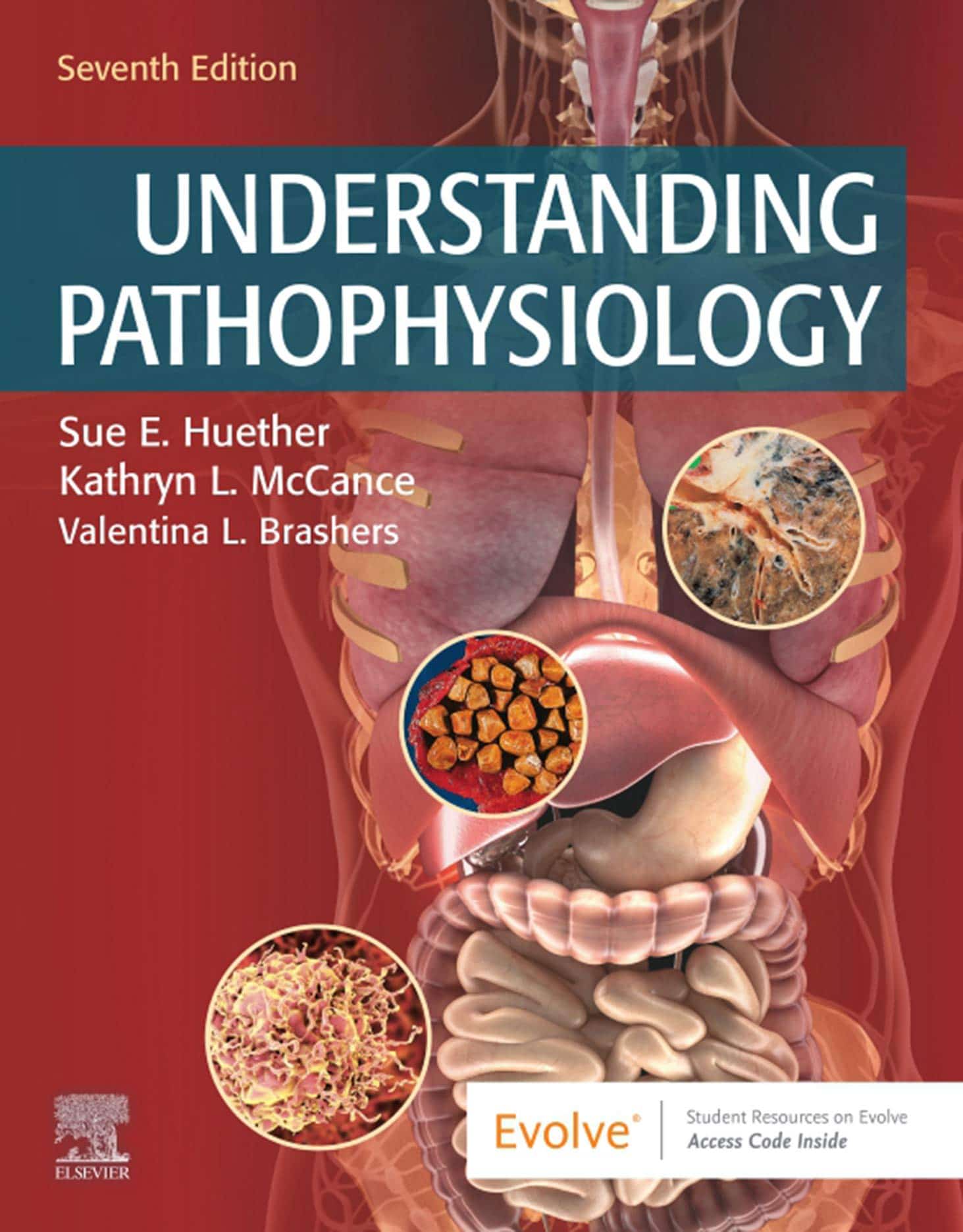 TEST BANK FOR UNDERSTANDING PATHOPHYSIOLOGY 7TH EDITION BY SUE HUENTHER